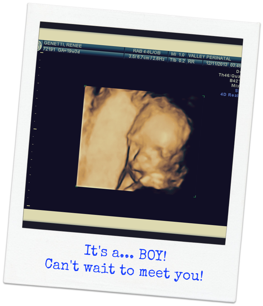Baby Diaries Ultrasound Photo