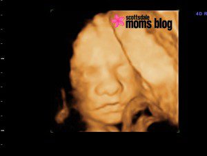 30-Week ultrasound